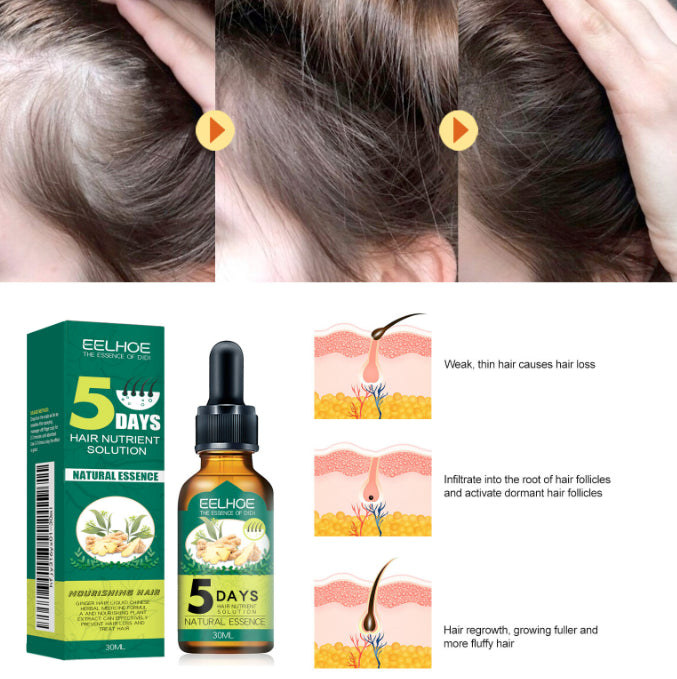 Olio Nutriente Anticaduta Capelli allo Zenzero – 30ML -             Eelhoe Ginger Hair Essential Oil
